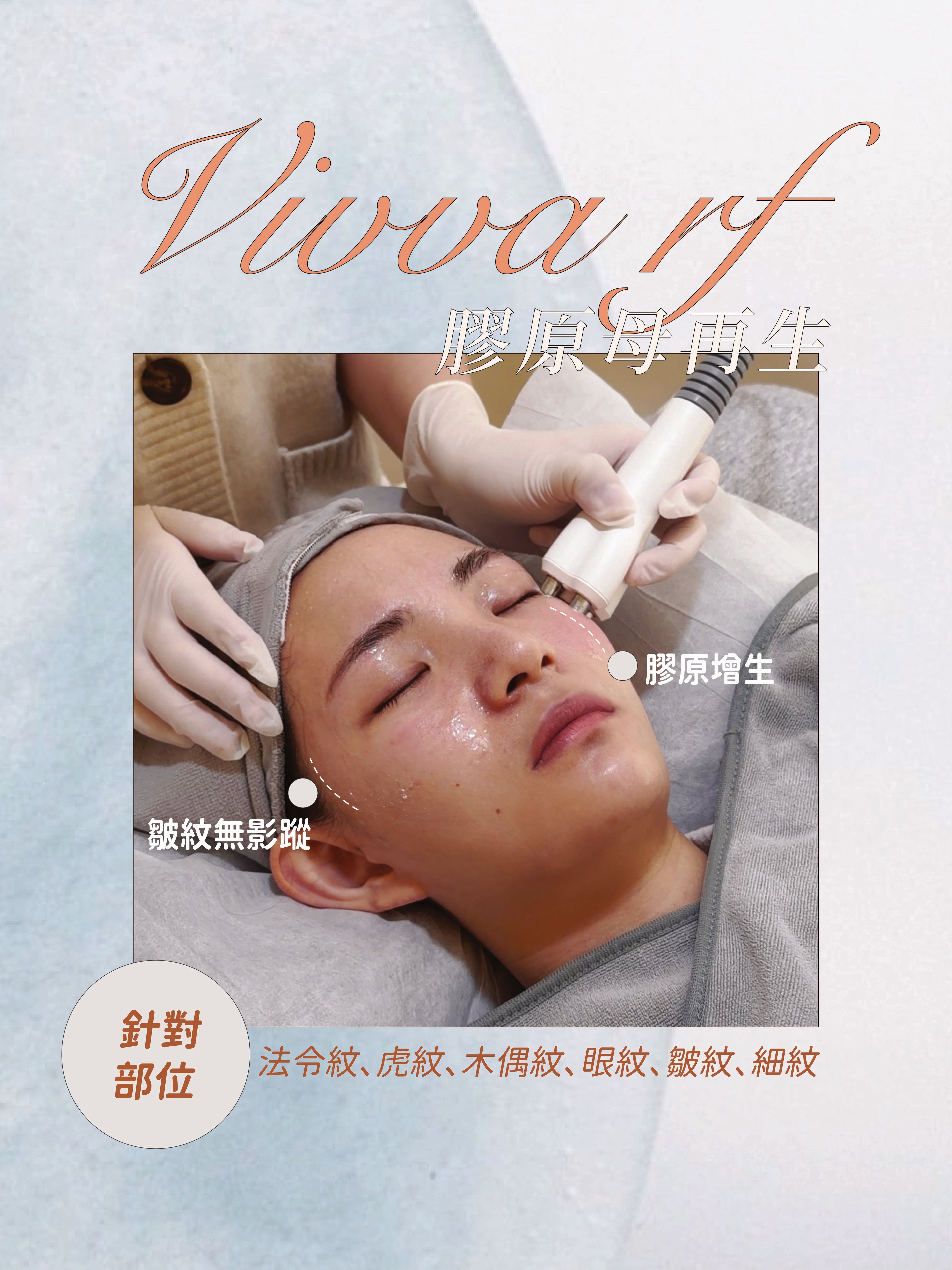 【去法令紋·蘋果肌提升】VIVA RF 膠原母再生