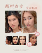 【新客戶限定】Young Plan 膠原青春全效方案