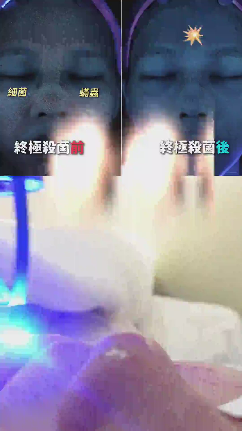 【新客戶限定】終極殺菌 - Plasma 等離子殺菌 + 藍雷射 (藍光) + 423光療 (藍光)